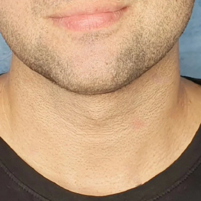 1dacd660-fb3a-11ea-9ab6-15f76f30b4df
